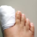 Understanding Nail Removal Surgery: What You Need to Know