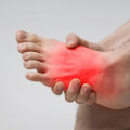 Understanding and Treating Burning Sensation on the Affected Toe
