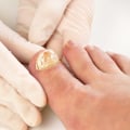 How do you test for toenail fungus?