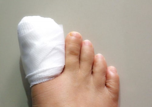Understanding Nail Removal Surgery: What You Need to Know