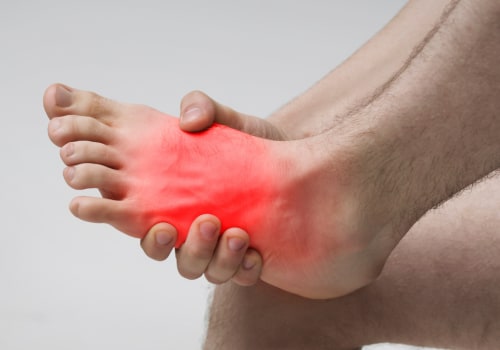 Understanding and Treating Burning Sensation on the Affected Toe